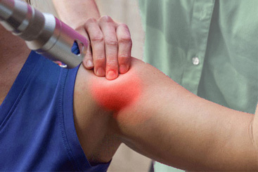 Laser Therapy on Shoulder